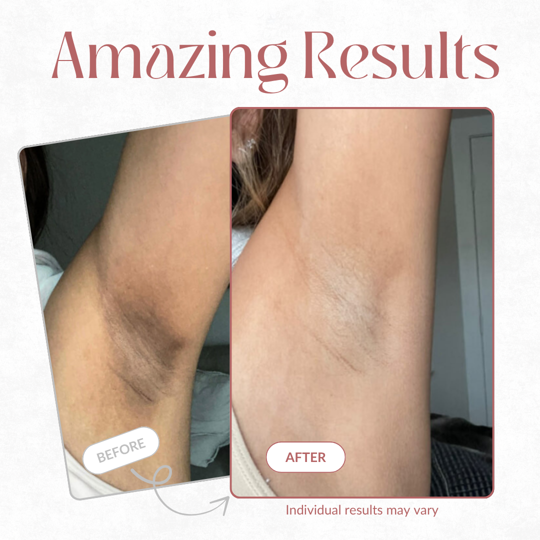 Zenknee Peel Shot - Kojic + Turmeric Body Peel Spray